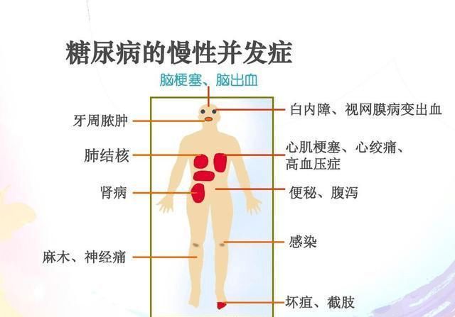 血糖标准范围最新更新